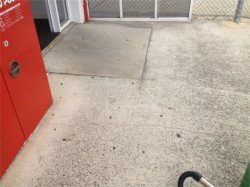 gum-removal-before